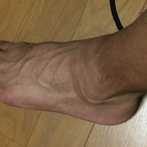 HOKA クリフトン2